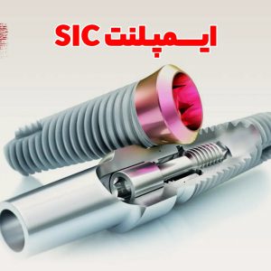 قبل از کاشت ایمپلنت در تهران، این تفاوت مهم بین برند SIC و سایر برندها را بدانید