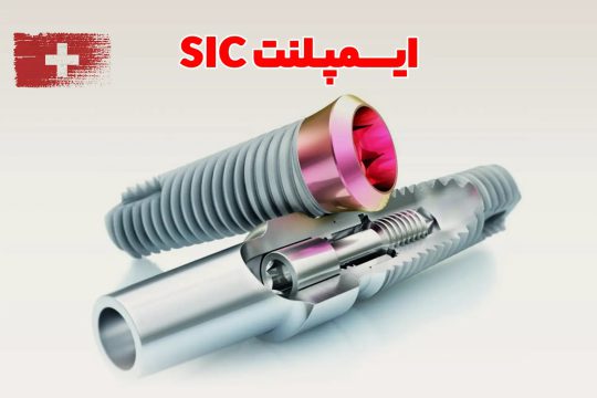 قبل از کاشت ایمپلنت در تهران، این تفاوت مهم بین برند SIC و سایر برندها را بدانید