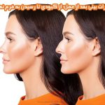 تغییرات بینی بعد از عمل؛ از کبودی تا رسیدن به فرم نهایی