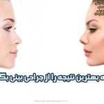 چگونه بهترین نتیجه را از جراحی بینی بگیریم؟