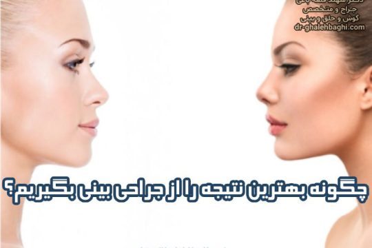 چگونه بهترین نتیجه را از جراحی بینی بگیریم؟