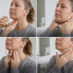 ماساژ بعد از ساکشن غبغب چگونه است و چه اهمیتی دارد؟