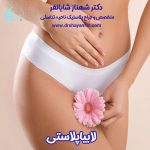 چرا بعضی از زنان بعد از لابیاپلاستی احساس رضایت بیشتری دارند؟