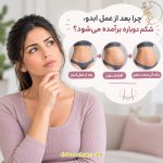 چرا بعد از عمل ابدو، شکم دوباره برآمده میشه؟