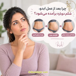 چرا بعد از عمل ابدو، شکم دوباره برآمده میشه؟