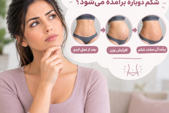 چرا بعد از عمل ابدو، شکم دوباره برآمده میشه؟