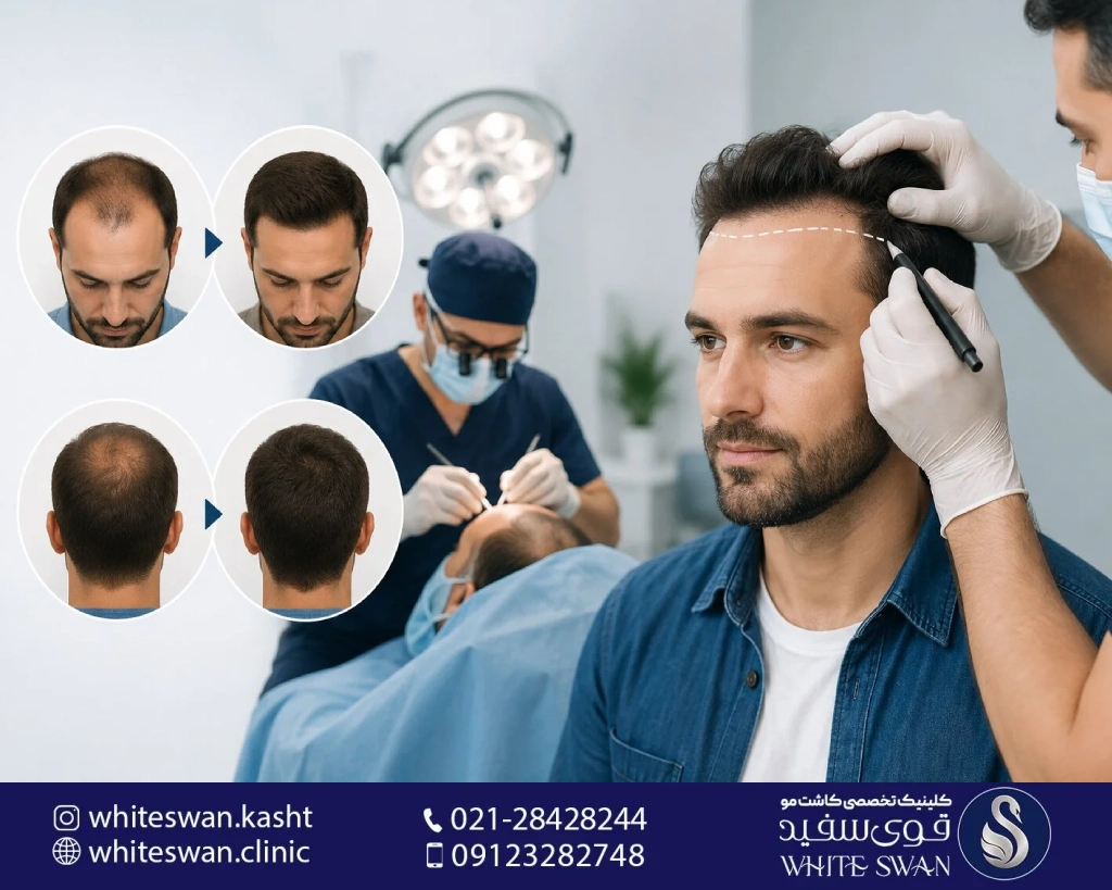 خدمات مو